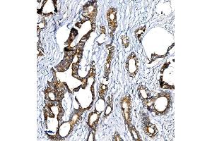 IHC analysis of BCKDHA using anti-BCKDHA antibody (ABIN7601223).
