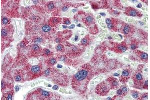 Liver, Human: Formalin-Fixed, Paraffin-Embedded (FFPE)