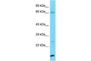 Host: Rabbit Target Name: KPRP Sample Type: Jurkat Whole Cell lysates Antibody Dilution: 1. (KPRP anticorps  (C-Term))