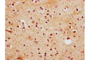 IHC image of ABIN7155766 diluted at 1:400 and staining in paraffin-embedded human brain tissue performed on a Leica BondTM system. (Homeobox D13 anticorps  (AA 151-254))