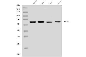 Western blot analysis of DAI/ZBP1 using anti-DAI/ZBP1 antibody (ABIN7600499).