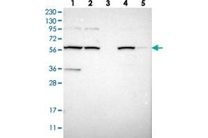 Western blot analysis of Lane 1: RT-4, Lane 2: U-251 MG, Lane 3: Human Plasma, Lane 4: Liver, Lane 5: Tonsil with MBOAT2 polyclonal antibody .