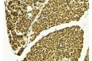 ABIN6276391 at 1/100 staining Mouse pancreas tissue by IHC-P. (SMNDC1 anticorps)