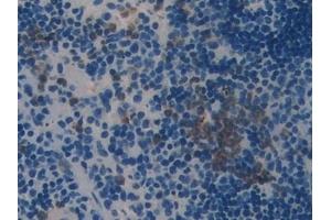 Detection of LEI in Mouse Spleen Tissue using Polyclonal Antibody to Leukocyte Elastase Inhibitor (LEI)