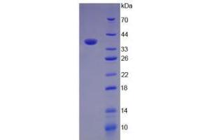 SDS-PAGE analysis of Mouse C3a Protein. (C3a Protéine)