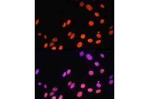 Immunofluorescence analysis of NIH-3T3 cells using MonoMethyl-Histone H3-R17 Rabbit pAb (ABIN3017467, ABIN3017468, ABIN3017469 and ABIN6220100) at dilution of 100 (40x lens).