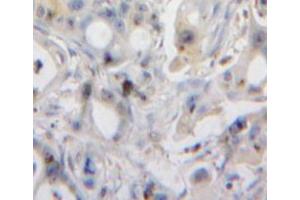 Used in DAB staining on fromalin fixed paraffin-embedded pancreas tissue (REG3A anticorps  (AA 25-142))