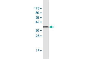 Western Blot detection against Immunogen (40. (CD59 anticorps  (AA 1-128))