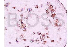Formalin-fixed and paraffin embedded human placenta tissue labeled with Anti-CD105 Polyclonal Antibody, Unconjugated at 1:200, followed by conjugation to the secondary antibody and DAB staining (Endoglin anticorps  (AA 601-658))