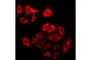 Immunofluorescent analysis of Myosin 1 staining in U2OS cells. (MYH1 anticorps)