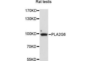 Western blot analysis of extracts of rat testis, using PLA2G6 antibody (ABIN5996267) at 1/1000 dilution.