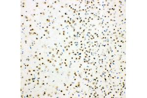 Anti-HDAC3 antibody,  IHC(F) IHC(F): Mouse Brain Tissue