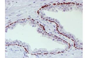 Image no. 1 for anti-WW Domain Containing Transcription Regulator 1 (WWTR1) antibody (ABIN1501763) (WWTR1 anticorps)