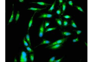 Immunofluorescence staining of Hela cells with ABIN7169132 at 1:266, counter-stained with DAPI. (PAK4 anticorps  (AA 1-426))