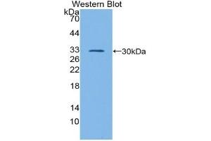 Detection of Recombinant GATA1, Mouse using Polyclonal Antibody to GATA Binding Protein 1 (GATA1)