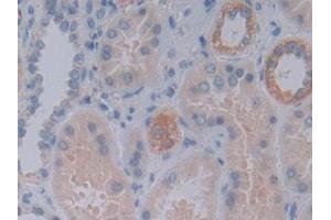 Detection of FKBP7 in Human Kidney Tissue using Polyclonal Antibody to FK506 Binding Protein 7 (FKBP7)