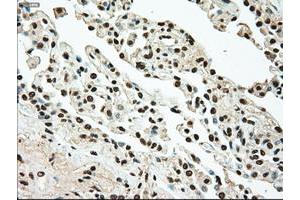 Image no. 1 for anti-TYRO3 Protein Tyrosine Kinase (TYRO3) antibody (ABIN1501608)