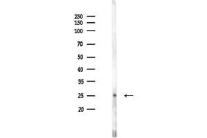 Western blot analysis of lysates from F10-LUC cells(starvation 24h treatment), using EIF3K Antibody at 1/1000 dilution.