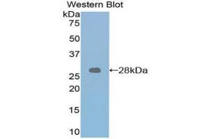 Western Blotting (WB) image for anti-Retinoic Acid Receptor, alpha (RARA) (AA 237-459) antibody (ABIN1860407) (Retinoic Acid Receptor alpha anticorps  (AA 237-459))