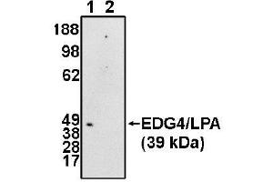 Image no. 1 for anti-Lysophosphatidic Acid Receptor 2 (LPAR2) (N-Term) antibody (ABIN265051) (EDG4 anticorps  (N-Term))