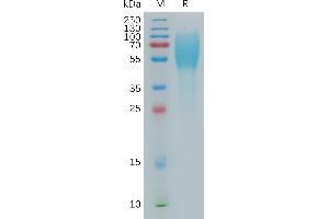 Human L Protein, His Tag on SDS-PAGE under reducing condition.