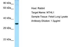 Western Blotting (WB) image for anti-Nth Endonuclease III-Like 1 (NTHL1) (N-Term) antibody (ABIN2789777)