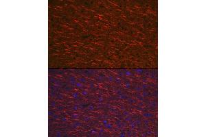 anti-Microtubule-Associated Protein 2 (MAP2) (AA 260-559) antibody