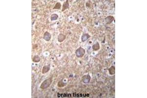 Immunohistochemistry (IHC) image for anti-RAS Guanyl Releasing Protein 2 (Calcium and DAG-Regulated) (RASGRP2) antibody (ABIN2996572)