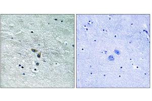 Immunohistochemistry analysis of paraffin-embedded human brain tissue using MAP3K8 (epitope around residue 400) antibody.