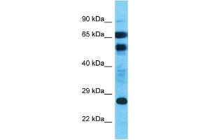 Host:  Rabbit  Target Name:  MLLT4-AS1  Sample Type:  Uterus Tumor lysates  Antibody Dilution:  1. (MLLT4-AS1 anticorps  (C-Term))
