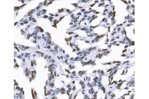 IHC analysis of SUN2 using anti-SUN2 antibody (ABIN7601278). (SUN2 anticorps  (AA 31-695))