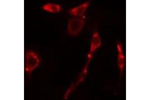 anti-Kinase Suppressor of Ras 1 (KSR1) (Internal Region) antibody
