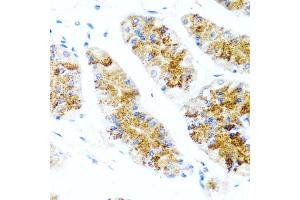 Immunohistochemistry of paraffin-embedded human stomach using SIRT1 antibody (ABIN5970059) at dilution of 1/100 (40x lens). (SIRT1 anticorps  (C-Term))