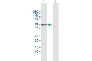 Western Blot analysis of SCLY expression in transfected 293T cell line by SCLY MaxPab polyclonal antibody.