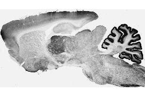Adult rat brain immunohistochemistry. (Cav3.1 Ca2+ Channel (AA 2052-2172), (C-Term), (Cytosolic) anticorps)