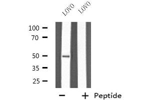 Western blot analysis of extracts from LOVO cells, using KRT37/38 antibody. (KRT37,38 anticorps)
