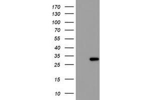 Western Blotting (WB) image for anti-Regulatory Factor X-Associated Ankyrin Containing Protein (RFXANK) antibody (ABIN1500685) (RFXANK anticorps)