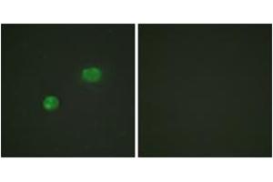 Immunofluorescence analysis of HeLa cells, using c-Jun (Ab-231) Antibody. (C-JUN anticorps  (AA 201-250))
