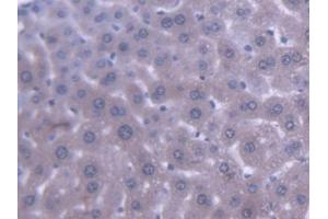 DAB staining on IHC-P; Samples: Mouse Liver Tissue (ABCB9 anticorps  (AA 500-762))