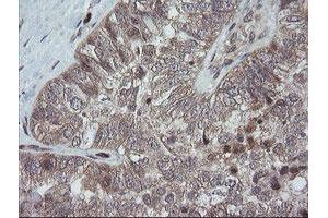 Image no. 2 for anti-Trafficking Protein Particle Complex 4 (TRAPPC4) antibody (ABIN1501263)