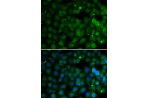 Immunofluorescence analysis of U20S cell using HPD antibody. (HPD anticorps)