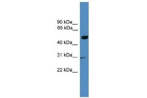 WB Suggested Anti-GAL3ST3 Antibody Titration:  0.