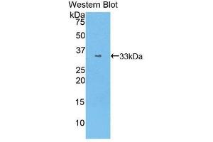 Western Blotting (WB) image for anti-Signal Transducer and Activator of Transcription 1, 91kDa (STAT1) (AA 343-602) antibody (ABIN3206143) (STAT1 anticorps  (AA 343-602))