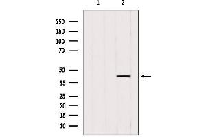 Western blot analysis of extracts from 3T3, using ACAA1 antibody. (ACAA1 anticorps  (N-Term))