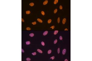 Immunofluorescence analysis of U-2 OS cells using SET/T Rabbit mAb (ABIN7270265) at dilution of 1:100 (40x lens).