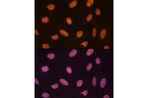 Immunofluorescence analysis of U-2 OS cells using SET/T Rabbit mAb (ABIN7270265) at dilution of 1:100 (40x lens). (SET/TAF-I anticorps)