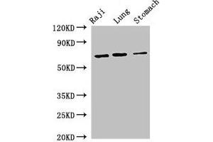 Western Blot Positive WB detected in: Raji whole cell lysate, Mouse lung tissue, Mouse stomach tissue All lanes: FOXN1 antibody at 2. (FOXN1 anticorps  (AA 1-160))