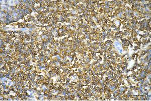 Immunohistochemistry was performed on paraffin-embedded human tonsillitis using CD44 antibody (ABIN7797973), 1:200).