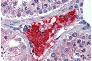 Human Testis: Formalin-Fixed, Paraffin-Embedded (FFPE) (PRTFDC1 anticorps  (Internal Region))