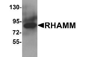 Western blot analysis of RHAMM in rat stomach tissue lysate with RHAMM antibody at 1 µg/mL.